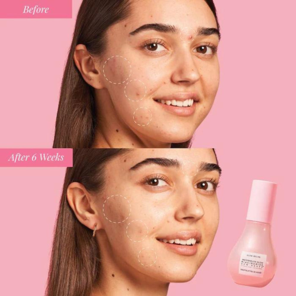 Glow Recipe Watermelon Glow Niacinamide Dew Drops – 40ml